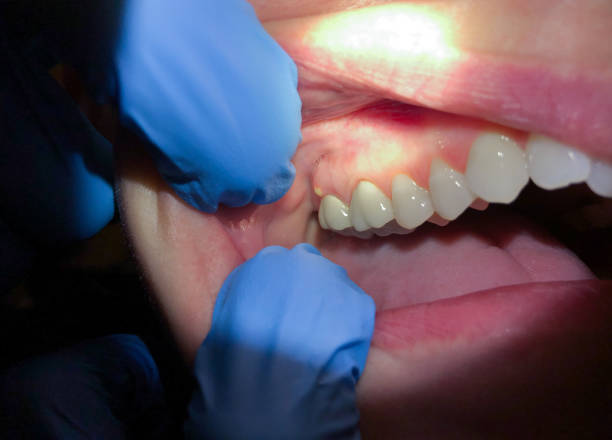Best Emergency Dentist Near Me  in Williamsburg, PA